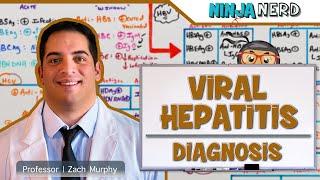 Hepatitis  Diagnosis of Viral Hepatitis