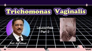 Leucorrhea Masterclass Part 2 Trichomonas Vaginitis