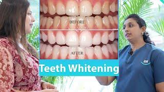 Teeth Whitening... Smile Kochi Dental Clinic +91 7999995339 +91 8877077079