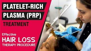 Platelet-Rich Plasma PRP Treatment - Effective Hair Loss Therapy Procedure  Sakhiya Skin Clinic