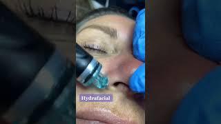 The Complete HydraFacial Experience Demystified #beauty #skincare #shorts
