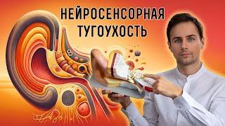 Самый частый тип снижения слуха  Сенсоневральная тугоухость. Диагностика профилактика лечение.