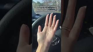 Sweaty hands & driving are becoming a safety issue at this point 