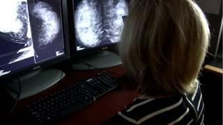 RSF Genetic Risk Assessment for Breast Cancer