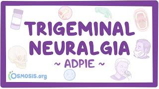 Trigeminal neuralgia Nursing Process ADPIE