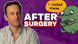 Life after Gallbladder SURGERY 5 Things your doctor DIDNT tell you