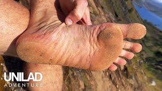 How I Transformed My Feet By Going Barefoot    UNILAD Adventure