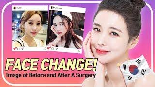 BYUL Which plastic surgery clinic in Korea is famous?