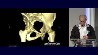 23  VIDEO  Acetabular Fractures   Amir Matiyahu MD 019