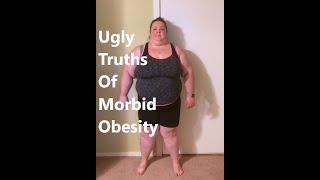 Ugly Truths of Morbid Obesity