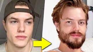 How to Grow a Beard From Nothing FULL GUIDE