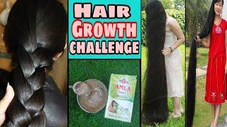 इस रेमेडी को एक बार लगाने से ही बालों की ग्रोथ दुगनी तेज़ी से होने लगेगी  Overnight hair growth