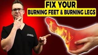 Burning Legs & Burning Feet at Night Treatment & Home Remedies