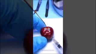 Cherry and worms #fruitsurgery #shorts