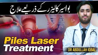 Bawaseer Ka Ilaj  Piles Ka Ilaj Without Surgery  Laser Piles Procedure Benefits
