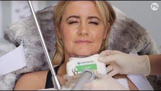 My Coolsculpting Fat Freeze Experience - Is it worth the money?