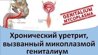 Хронический уретрит вызванный микоплазмой гениталиум