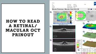 HOW TO READ MACULAR OCT PRINTOUT? made easy