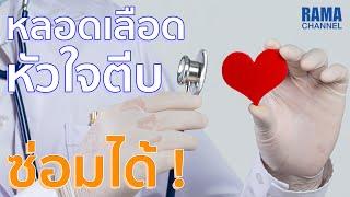 หลอดเลือดหัวใจตีบ ซ่อมได้ 