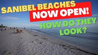 Sanibel Beaches Open To The Public How Do They Look?