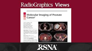 Molecular Imaging of Prostate Cancer