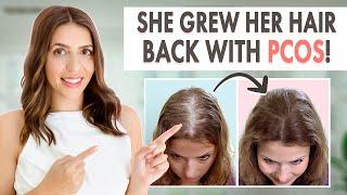How Stephanie Grew Her Hair Back  Her PCOS Hair Loss Journey & Treatment