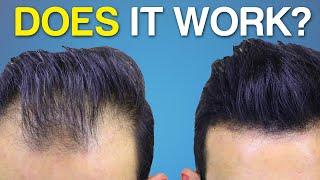 Does Hair Fiber SPRAY Work? BETTER Hair Coverage?