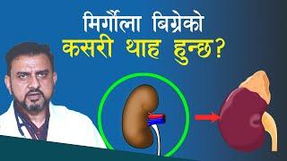 किडनी बिग्रेको संकेत यस्ता....डा.  अनिल पोखरेल Niko Nepal - Kidney Disease in Nepal