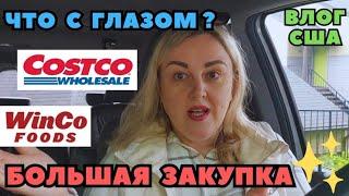 Большая Продуктовая ЗАКУПКА COSTCO & WINCO FOODS Что с глазом?