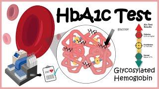 HbA1c Test  Glycosylation of haemoglobin  Diabetes