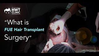 What is FUE Hair Transplant Surgery ?