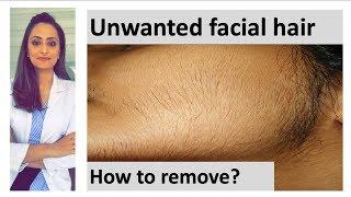 How to remove facial hair  unwanted facial hair  causestreatmentDermatologist Dr. Aanchal Panth