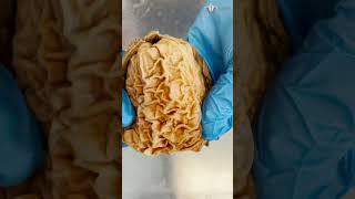 Looking Inside a Real Human Stomach  #shorts #food