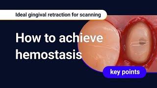 How to achieve hemostasis