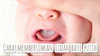 CARA MEMBERSIHKAN LIDAH BAYI YANG PUTIH