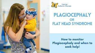 How to Tell if Your Baby has Plagiocephaly