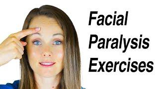 Facial Paralysis Exercises for Bells Palsy