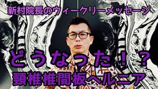 頸椎椎間板ヘルニアはどうなった？新村院長のウィークリーメッセージ第216弾