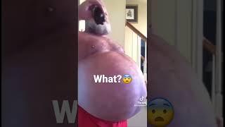 Big belly man #shorts #shortsvideo #shocking