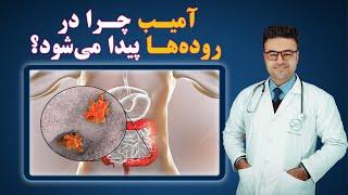 آمیب چرا در روده ها پیدا میشود؟ داکتر قیس نیکزاد