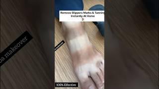 SunTan RemoveFeet Cleaning Hometips ll #pedicure#spotremove #skincare #ytshorts #viralvedio#shorts