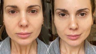 Ive used NuFace for 30 days and this is my review  ALI ANDREEA