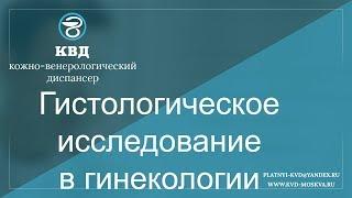 564  Гистологическое исследование в гинекологии