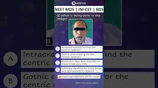 NEET MDS  INI-CET MDS  PSC  BDS - Most Important Questions  #neetmds2025 #mdsprep