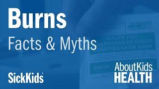 Crazy Creams Facts about Burn Healing  Faits et mythes sur les soins des brûlures