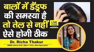 Dr. Richa Thakur बता रही हैं Dandruff की समस्या बालों में है तो तेल लगाने से नहीं ऐसे ठीक होगी