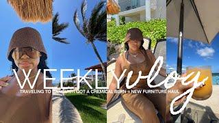 Weekly Vlog Girls Trip to Cancun Mexico + I got a chemical burn + new furniture & more chelsiejayy
