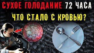 Сухое голодание 72 часа 3 дня. Что стало с кровью под микроскопом?