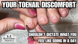 Are the Corners of your Toenails Sore but your Nails look Completely Normal? #nails