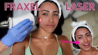 DAY IN MY LIFE VLOG  Got Fraxel Laser & Our New Cloud Couch Dupe Arrived